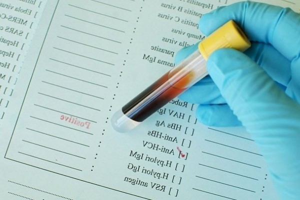 Анализы на гепатит С в Москве: полный список тестов перед терапией. Расшифровка ПЦР, генотипирование и фиброз. Узнайте, как правильно подготовиться к лечению!